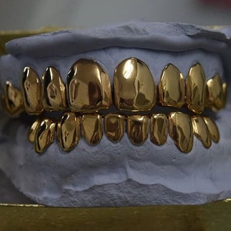 14K Gold GRILLZ